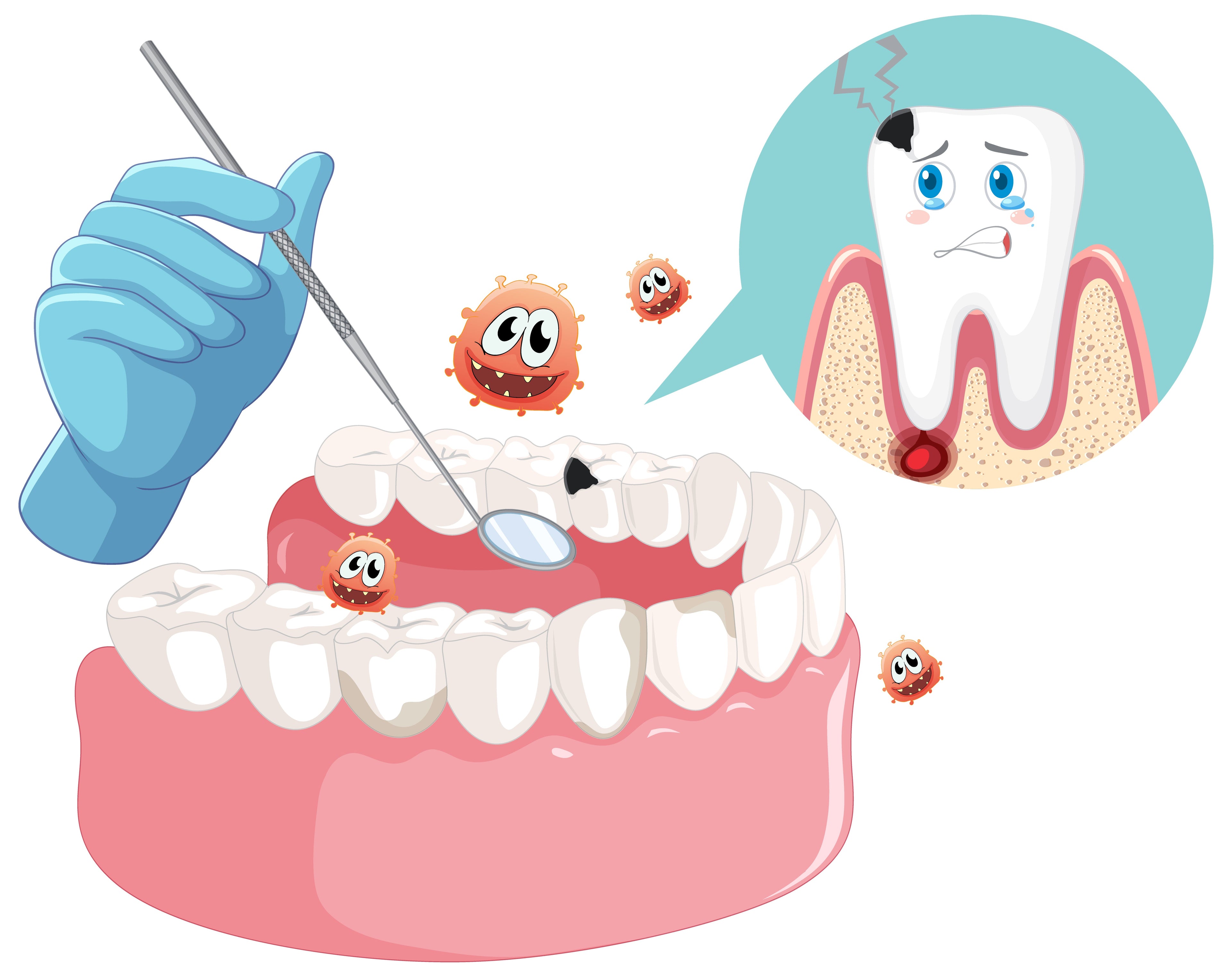 Amalgam Cavitation